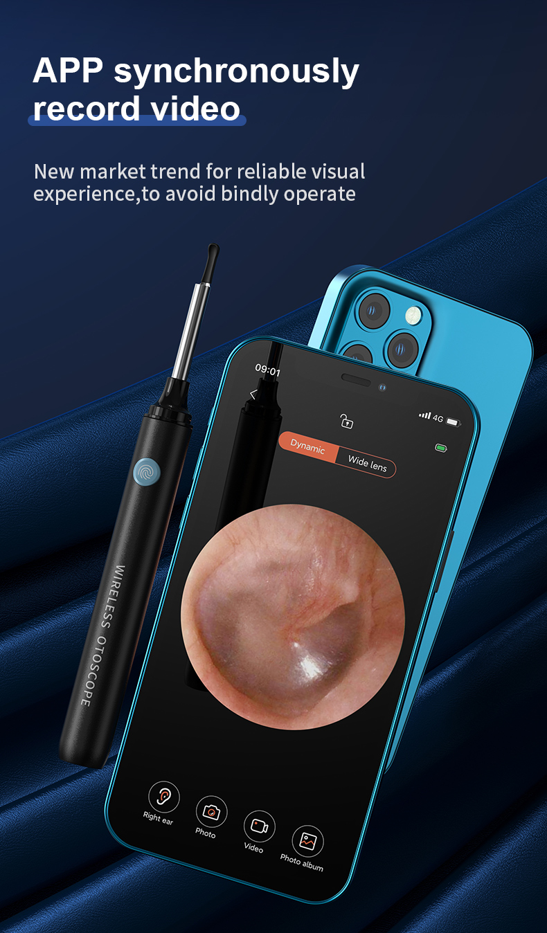 SUNUO Find-B Pro Portable Smart Ear Wax Cleaner with Otoscope Camera