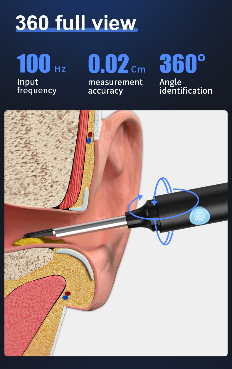 SUNUO Find-B Pro Portable Smart Ear Wax Cleaner with Otoscope Camera