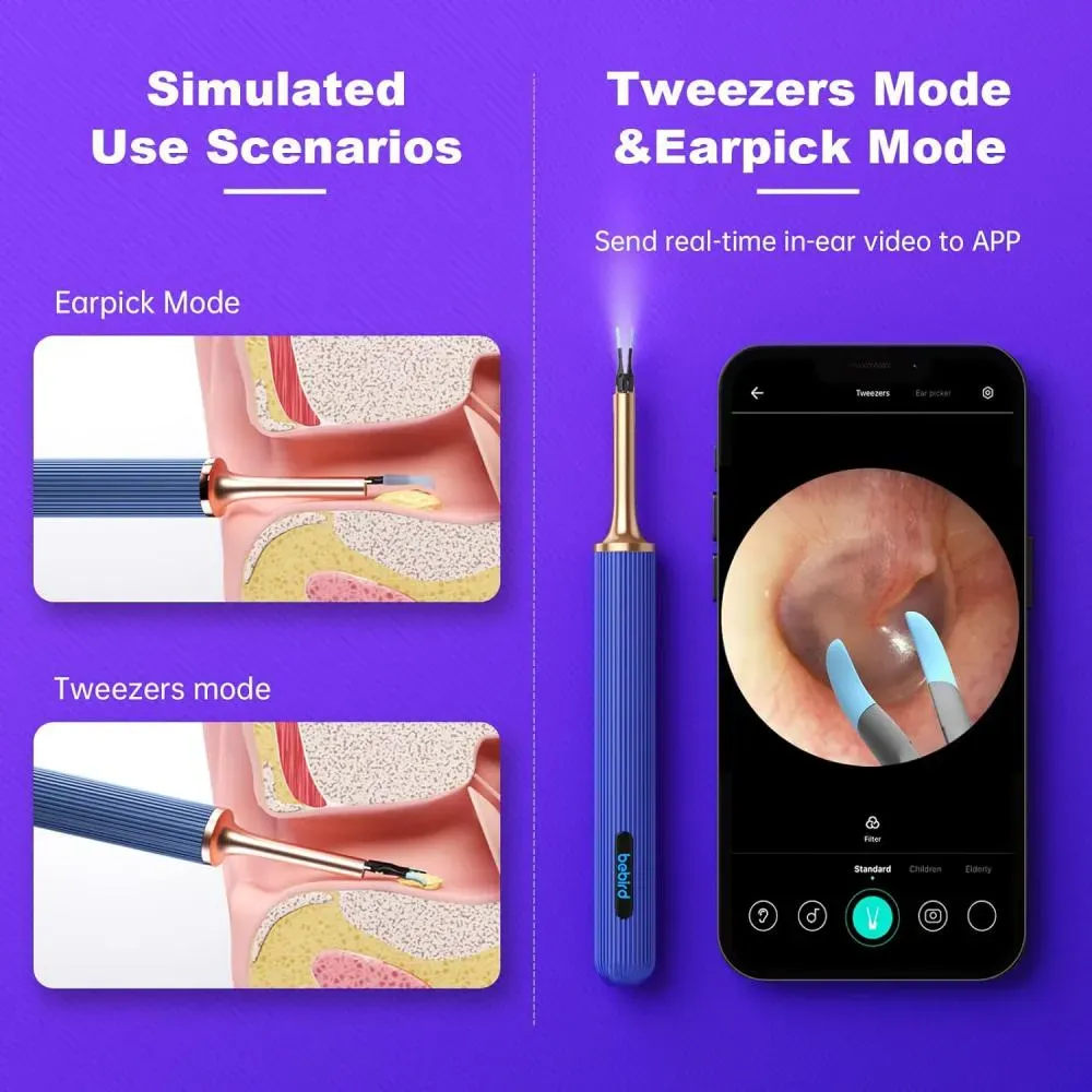 BEBIRD Note3 Pro Max 10 Megapixel HD All-in-1 Ear Wax Removal with Camera